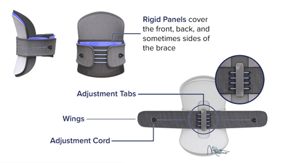Typical Components of a Back Brace